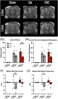 Fecal microbial transplantation limits neural injury severity and functional deficits in a pediatric piglet traumatic brain injury model